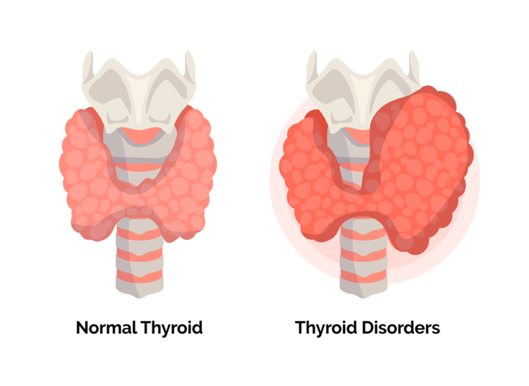 Endocrinology Services
